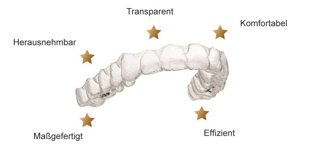 Vorteile der Invisalign Spange invisalign-vorteile