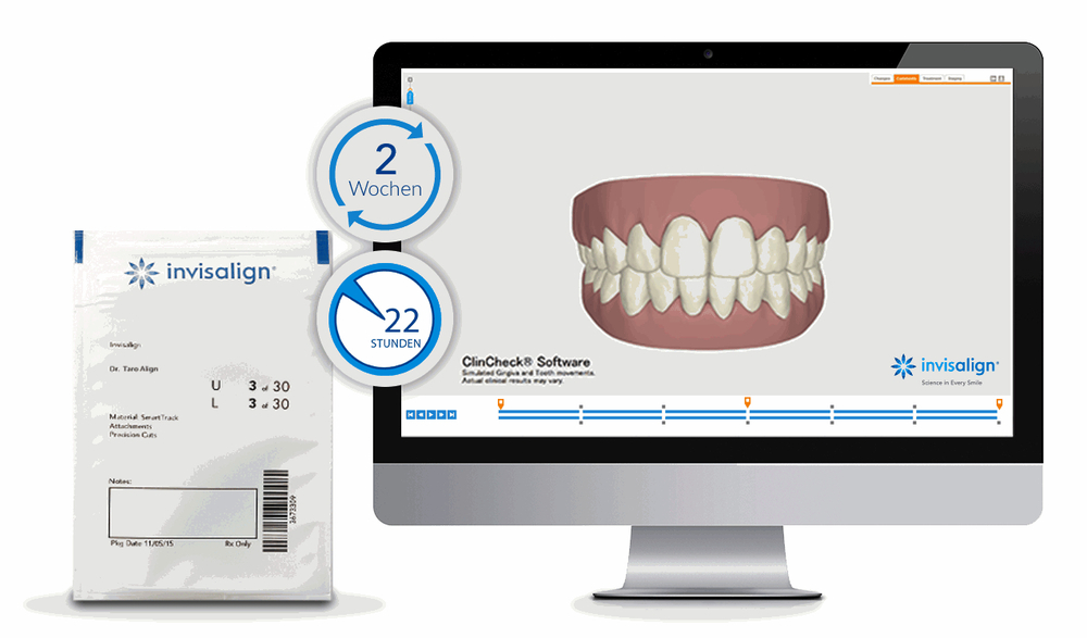 Clin-Check Invisalign auf iMac Clin-Check Invisalign auf iMac